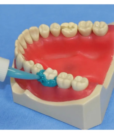 Impression Products, Trays & Mixing Tips
